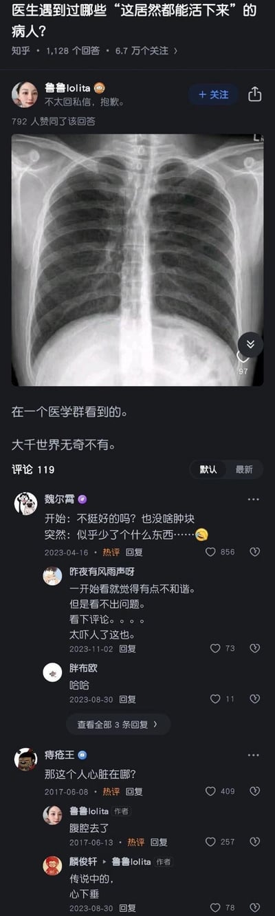 知乎平台上的一个问答截图，问题为“医生遇到过哪些‘这居然都能活下来’的病人？”。用户“鲁鲁loliita”分享了一张胸部X光片，并配文“在一个医学群看到的。大千世界无奇不有。”。下方评论区引发热议，有用户指出X光片中似乎缺少心脏（“心脏去哪了？”），众人对病人能存活表示惊讶，讨论该异常X光片背后的可能情况。