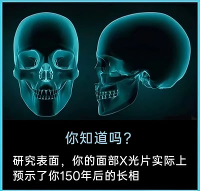 图片展示了两张蓝色调的头骨X光影像，左侧为正面视图，右侧为侧面视图，背景为深色，边缘有蓝色边框。下方配有文字：“你知道吗？研究表面，你的面部X光片实际上预示了你150年后的长相”。这是一个幽默梗图，通过调侃“150年后人会变成骷髅”的常识，将X光片（显示头骨）戏称为能预测未来长相的“预言”。