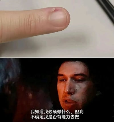 图片分为上下两部分。上半部分是拇指的特写，指甲边缘有一道细小的伤口，伤口处略显红肿，看起来像是刚被划伤不久。下半部分是一名男子的面部截图，他神情严肃，眼神中带着些许疲惫和苦恼，背景光线较暗，整体氛围沉重。图片底部配有文字：“我知道我必须做什么，但我不确定我是否有能力去做”。通过拇指的小伤口与男子沉重的内心独白形成对比，幽默地展现了人们面对微小困难却产生巨大心理压力的状态。