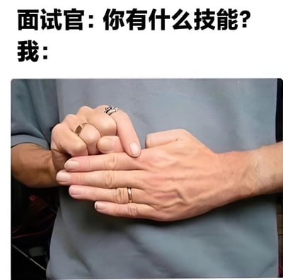 这是一张幽默梗图，上方文字显示面试官提问："你有什么技能?"，下方配图是一个人正在展示手指锁技的特写。通过将无实际职场价值的手指小技巧作为对技能问题的回答，形成了一种反差萌的幽默效果，调侃了求职者面对技能提问时的无奈或创意回答方式。
