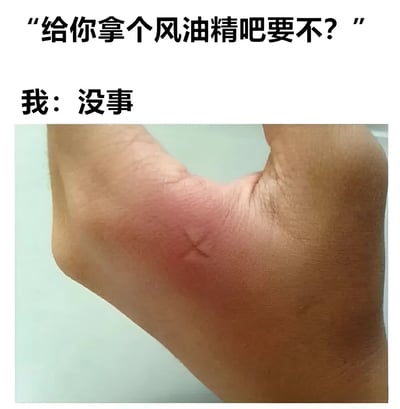 图片上方配有文字“给你拿个风油精吧要不？”，下方文字为“我：没事”，中间是一张真人胳膊的照片，胳膊肘处有明显的红肿区域，疑似被蚊虫叮咬或划伤后发炎。通过文字与图片的对比，形成“嘴上说没事，身体却很诚实”的幽默效果，展现了人们有时明明身体不适却嘴硬不愿承认的场景。