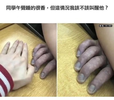 这是一张左右对比的视觉错位图，图上方配文“同學午覺睡的很香，但這情況我該不該叫醒他？”。左图里，一只正常肤色的手放在桌面，旁边有几只紫黑色的“手”，看起来像是同学午睡时被压得缺血变色的手，会让人产生要不要叫醒对方的纠结；右图里，正常肤色的手移开后，揭晓了真相：那紫黑色的“手”其实是桌子边缘的木纹，因为和同学的手臂放在一起，形成了视觉错位，看起来像是被压变色的手。这是利用视觉错觉制造的搞笑场景，揭晓真相后让人啼笑皆非。对于图中的问题，答案是不需要叫醒，因为这是视觉错位造成的误会，所谓“紫黑色的手”其实是桌子的木纹，同学的手并没有出现异常。
