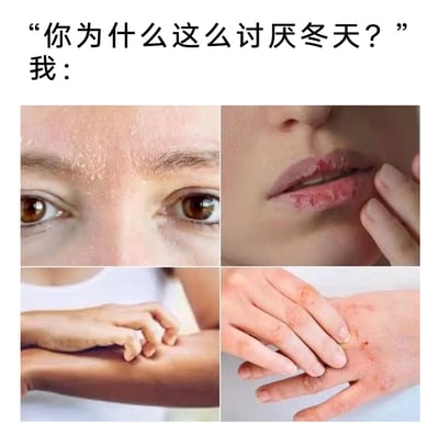这是一张图文结合的多图拼接内容，上方设置对话文字“你为什么这么讨厌冬天？”“我：”，下方通过四张真实的人体局部照片，直观呈现冬季气候带来的各类皮肤困扰：左上为脸部皮肤干燥起皮的状态，右上是嘴唇干裂破损甚至出血的画面，左下是人物因皮肤干痒而抓挠手臂的动作，右下是手部生冻疮、皮肤泛红干裂带有抓痕的状态，用这些真实的身体不适画面，精准传递出讨厌冬天的核心原因，极易引发有相同冬季皮肤问题人群的共鸣。
