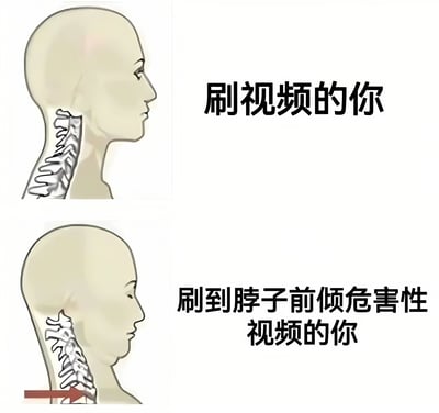 图片为上下两部分的对比图，上方左侧是正常颈椎姿势的头部侧面线稿图，右侧配有文字“刷视频的你”；下方左侧是颈椎前倾的头部侧面线稿图，用红色箭头标注前倾方向，右侧配有文字“刷到脖子前倾危害性视频的你”。通过夸张对比展现人们刷视频时从沉迷到意识到姿势问题的状态变化，具有幽默警示效果。