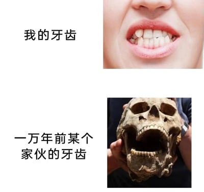 这是一张采用上下对比形式的趣味梗图，上方展示了一位皱着嘴露出牙齿的当代人，其牙齿排列拥挤、参差不齐，搭配配文“我的牙齿”；下方是一个被人双手捧着的远古人类头骨，头骨的牙齿排列得整齐紧密，搭配配文“一万年前某个家伙的牙齿”。图中通过强烈的反差对比，以幽默调侃的方式吐槽当代人常见的牙齿不齐问题，用夸张的对比制造出搞笑的效果。