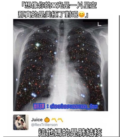 这张梗图上方配有文字“想像你的X光是一片星空 那真的是美極了對吧😊”，中间是一张经过编辑的肺部X光片，其中肺部区域被替换成了布满星星的星空效果。图片底部有一个用户评论“這他媽的是肺結核”，形成了诗意描述与残酷现实的幽默反差。图片中包含翻译水印“翻譯：doctormeme_tw”。