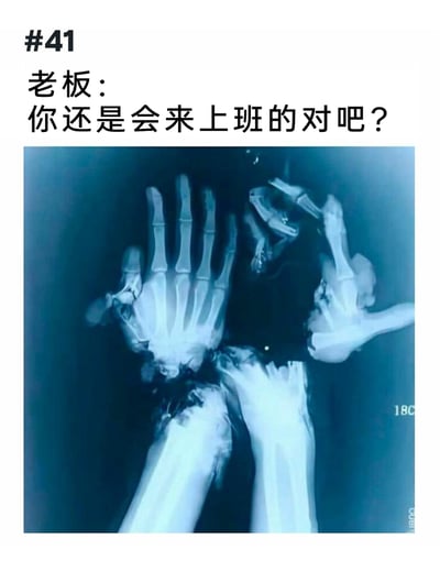 这是一张充满黑色幽默的职场吐槽梗图，画面上方标注序号“#41”，并配有老板的提问文字：“你还是会来上班的对吧？”；画面主体是一张蓝色调的X光片，展示了两只手部骨骼严重骨折、关节变形的手，却强行摆出了表示“没问题”的OK手势。这张图用夸张且讽刺的方式，刻画了当代职场中员工在面对老板的不合理期待时，即使身体遭受严重伤病，也不得不硬撑着表示自己可以继续工作的无奈与辛酸，精准戳中了职场人被工作压榨、身不由己的痛点，引发职场群体的共鸣。