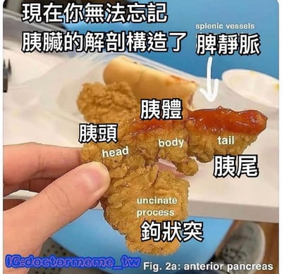 图片中一只手拿着一块炸鸡，炸鸡被巧妙地标注了胰脏的各个解剖结构：顶部文字写着“现在你无法忘记胰脏的解剖构造了”，炸鸡上分别用中英文标注了“胰头 (head)”、“胰体 (body)”、“胰尾 (tail)”、“钩状突 (uncinate process)”，右上角还有指向“脾静脉 (splenic vessels)”的标注。通过将炸鸡的形状与胰脏解剖结构类比，以幽默方式帮助记忆医学知识。
