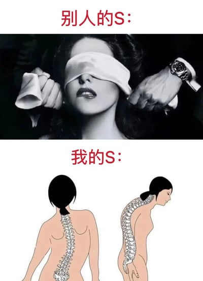 这是一张采用上下对比形式的搞笑梗图，通过双关手法制造反差笑点。上方配文“别人的S：”，搭配一张黑白氛围感真人图像，画面中一位女性被白色布条蒙住双眼，旁边的手正在调整蒙眼布，整体画面营造出神秘、性感的氛围，此处的“S”指代的是和性感（Sexy）相关的意象；下方配文“我的S：”，搭配卡通风格的人体脊柱示意图，分别展示了正常形态的脊柱和呈S形侧弯的脊柱，此处的“S”指代的是脊柱侧弯的S形态，通过这种双关对比，自嘲自己的“S”和他人代表性感的“S”有着巨大反差，以此调侃自身的身体状况，充满搞笑和自嘲的意味。
