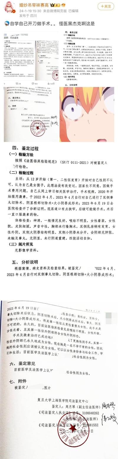 这是一条2024年1月19日发布于四川的微博内容，博主「婚纱吊带袜赛高」配文「自学自己开刀做手术。。怪医黑杰克啊这是」，并拼接了复旦大学上海医学院司法鉴定中心的司法鉴定报告截图与一张动漫人物惊恐脸截图。报告显示，被鉴定人自12岁起就认定自己是女孩，因家长反对、手术费用不足，自行从网络学习相关医学知识与手术视频，2020年开始服用激素，还在2022年、2023年自行完成双侧睾丸切除术、阴茎根部切除术+大小阴唇成形术，后续医院检查发现尿道口狭窄，最终司法鉴定认定其社会性别为女性。博主用动漫角色「怪医黑杰克」（自学成才的天才外科医生）调侃这一极端自行手术的行为，动漫图的惊恐表情也强化了事件的冲击感。