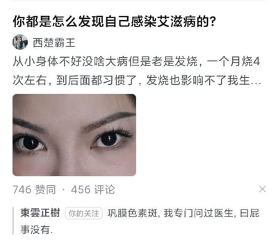 这是一张社交媒体评论截图，内容是关于艾滋病感染发现经历的讨论。上方有问题“你都是怎么发现自己感染艾滋病的？”，下方是用户“西楚霸王”的回复，提到自己从小经常发烧，一个月约4次，已经习惯。回复下方配有一张人物眼睛特写图片。评论区有用户“東雲正樹”评论提到“巩膜色素斑，我专门问过医生，曰屁事没有。”截图显示有746赞同和456评论。