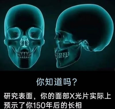 这是一张图文混排的搞笑冷梗图，上半部分展示了两张蓝绿色调的人类头骨X光渲染图，分别为正面视角和侧面视角；下半部分为黑色背景配白色文字，先以“你知道吗？”引出内容，后续文案故意将“研究表明”错写为“研究表面”，一本正经地调侃“面部X光片预示了人150年后的长相”，对应人去世后肉身腐烂仅余头骨的事实，用无厘头的表述制造笑点。