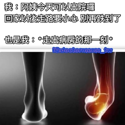 图片上半部分是文字内容，左侧写着“我：阿姨今天可以出院囉 回家以後走路要小心 别再跌到了”，右侧接着“也是我：*走出病房的那一刻*”。下半部分是两张脚踝的示意图对比，左侧为正常的X光风格脚踝图像，右侧脚踝处有明显的红色高亮区域，模拟受伤状态。整体通过文字和图像的结合，幽默地展现了“提醒别人注意却自己中招”的反差场景，带有自嘲和搞笑的意味。