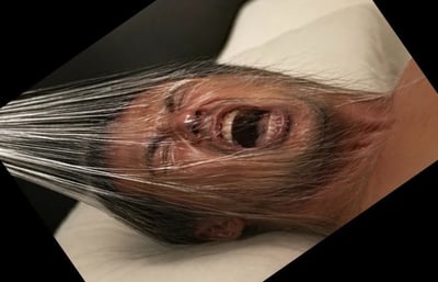 这是一张近距离真人特写照片。画面中央是一张被透明薄膜紧紧包裹的人脸，薄膜的拉力使皮肤和五官出现明显的横向拉伸与褶皱。人物双眼紧闭，鼻子和脸颊被压平，嘴巴大张露出上下排牙齿，呈现出痛苦、惊恐或窒息般的状态。头部下方可见白色枕头或衬底，周围有深色区域；整张照片被旋转后置于黑色背景中，形成菱形构图。图像没有文字、对白或明显水印，整体氛围猎奇、惊悚并具有强烈视觉冲击力。该行为可能造成呼吸困难，具有危险性，不应模仿。