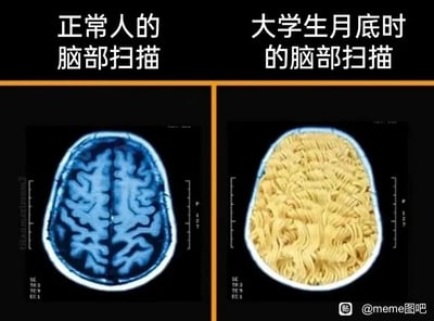 这是一张采用左右对比形式的网络搞笑梗图，左侧是真实的正常人脑部CT扫描图，上方标注“正常人的脑部扫描”，清晰呈现出脑部的结构形态；右侧则将CT图中的脑部区域替换成了黄色的泡面，上方标注“大学生月底时的脑部扫描”。该图通过夸张荒诞的视觉替换手法，调侃大学生群体在月底普遍面临生活费告罄、只能靠吃泡面度日的生活状态，用“脑子都被泡面占据”的搞笑设定制造反差感，精准戳中大学生月底经济拮据的共鸣点，充满生活化的幽默。