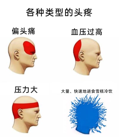 这是一张结合科普与幽默的静态拼接图，通过3D渲染的头部模型和创意化的图示，展示了四种不同诱因引发的头疼对应的头部感受或疼痛区域：左上角为偏头痛，对应头部单侧眼周及前额的红色高亮疼痛区域；右上角为血压过高引发的头疼，对应头部后侧及颈上部的红色高亮区域；左下角为压力大引发的头疼，对应头部双侧额颞及后颈的红色环绕区域；右下角则用被冰刺完全包裹的头部，夸张地表现大量、快速进食雪糕冷饮后，冷刺激带来的尖锐扩散式头疼，将日常场景中的不适以趣味化方式呈现。