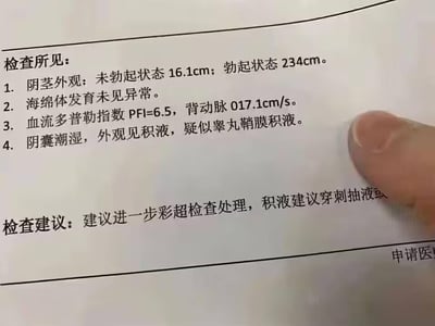 这是一份男性生殖系统的检查报告，记录了多项检查结果：1. 阴茎外观尺寸，未勃起状态为16.1cm，勃起状态记录为234cm，该数值明显存在书写错误，合理数值应为23.4cm左右；2. 海绵体发育未见异常；3. 血流多普勒指数PFI=6.5，背动脉流速记录为017.1cm/s，其中开头的“0”应为书写冗余；4. 阴囊潮湿，外观可见积液，疑似睾丸鞘膜积液。检查建议部分提到，建议患者进行进一步彩超检查处理，针对积液问题建议穿刺抽液，内容未完全显示。报告右下角可见部分“申请医”字样，应为“申请医师”的未完整书写内容，图片右下角还有一根手指遮挡了部分文字。