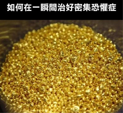 图片上方为黑色背景白色文字“如何在一瞬间治好密集恐惧症”，下方是一堆密集排列的金黄色颗粒（疑似黄金碎块）的特写。图片通过幽默手法，利用人们对黄金的喜爱来调侃密集恐惧症，暗示面对密集但有价值的黄金时，密集恐惧症状会“瞬间消失”。
