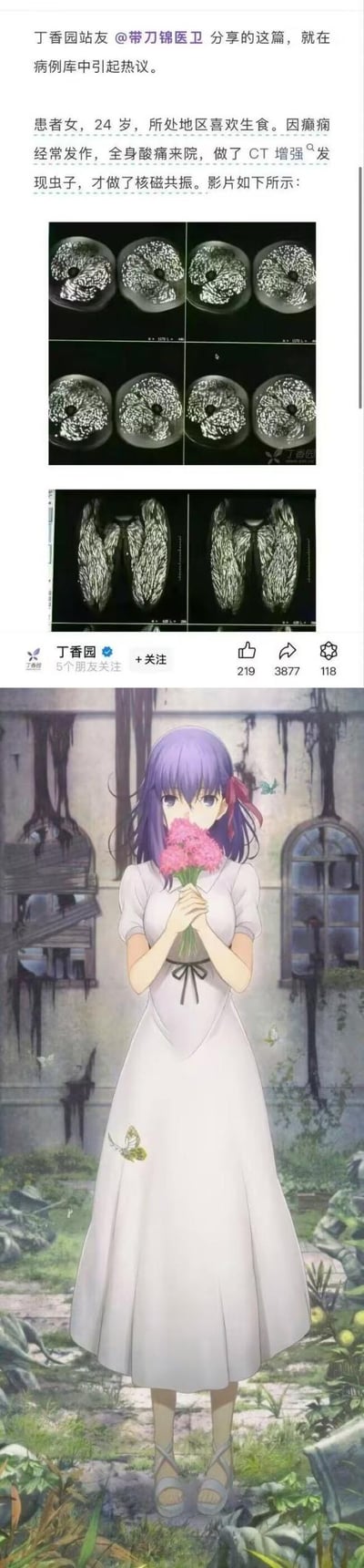 这是一张二次创作的拼接梗图，上半部分是医疗平台丁香园的病例分享截图：一位24岁有生食习惯的女性，因癫痫发作、全身酸痛就诊，CT增强与核磁共振的影像显示脑部、脊髓布满类似虫体的异常纹路，该病例在平台病例库引发热议；下半部分是TYPE-MOON旗下《Fate/stay night》的角色间桐樱的动画截图，该角色的核心设定为被刻印虫寄生，图中她双手捧着粉色花束，神情平静略带忧郁。这张梗图将医疗病例的异常影像与动漫角色的核心设定做趣味联动，玩设定对应的巧合梗。