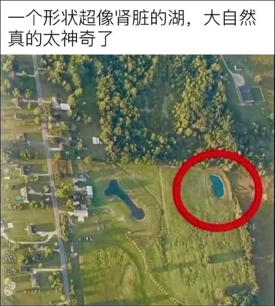 这是一张航拍郊外景观的趣味梗图，属于顶配底文的图文混排形式。图片顶部配文称“一个形状超像肾脏的湖，大自然真的太神奇了”，并用红色圆圈在画面右侧圈出了一个小型的半圆形蓝色水池，但实际上画面左侧的天然湖泊形状才和人体肾脏高度相似，发布者故意标错目标制造反差笑点。画面左下角带有“厚多士”字样和微信图标水印，背景可见居民区住宅、道路、林地与大片草坪。