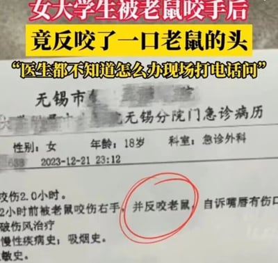这是一张带有文字加注的医院急诊病历实拍图，画面上方用红色和黄色的醒目字体标注了标题“女大学生被老鼠咬手后竟反咬了一口老鼠的头”，还有副标题“医生都不知道怎么办现场打电话问”，点明了事件的戏剧性。下方的病历为无锡市某医院无锡分院的门急诊病历，记录了一位18岁女性患者的就诊情况：就诊时间为2023年12月21日23:12，科室为急诊外科，患者2小时前被老鼠咬伤右手，随后反咬了老鼠，自诉嘴唇有伤口，正在接受破伤风治疗，无慢性疾病史、吸烟史等特殊病史。其中“并反咬老鼠”这一特殊行为被红色圆圈圈出，成为整个画面的核心趣味点，这种罕见的互咬情况打破了常规的被动物咬伤的就医场景，显得荒诞又好笑。