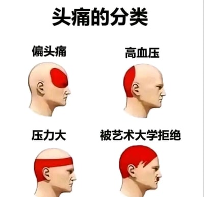 这是一张幽默风格的头痛分类图，上方标题为“头痛的分类”，下方分四格展示不同类型头痛的示意图：左上角“偏头痛”对应头部左侧红色区域，右上角“高血压”对应头部后侧红色区域，左下角“压力大”对应额头横向红色条带，右下角“被艺术大学拒绝”则是整个头顶呈红色。通过将医学常见头痛类型与“被艺术大学拒绝”这一生活化幽默场景结合，用夸张的红色疼痛区域示意图制造反差笑点。