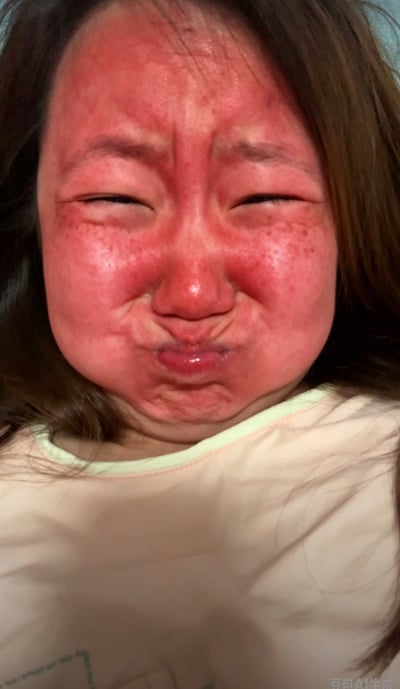 这是一张真人实拍竖图，图中的女性按照“爆缸笑脸”教学的三步动作完成操作后，呈现出对应的状态：整张脸涨得通红，眉头紧皱，双眼眯起，脸颊鼓起，嘴唇噘起皱起，整个人呈现出憋气后难受的神态，完美契合教学第三步的“难受”效果，表情夸张搞怪，极具反差幽默感。