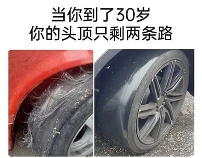 这是一张左右对比的图文梗图，上方配有文字“当你到了30岁 你的头顶只剩两条路”。左侧是磨损严重的轮胎，胎面边缘长出杂乱的纤维，用来比喻30岁人群脱发后，头顶两侧只剩稀疏头发的状态；右侧是光滑的光头样式轮胎，对应30岁人群直接秃顶的情况。图中用轮胎的两种状态双关调侃30岁群体的脱发困境，以形象的类比制造出幽默自嘲的效果，精准戳中当代年轻人对中年脱发的焦虑。
