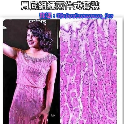 这是一张左右对比梗图，左侧为一位女性身着粉色亮片两件式连衣裙的照片，她面带微笑，单手叉腰展示服装；右侧是一张胃底组织的显微图像，其紫色纹理与左侧连衣裙的亮片排列极为相似。图片通过将时尚服装与医学组织图像进行视觉类比，制造出幽默效果。