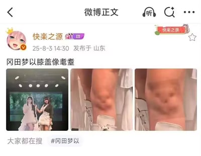 这是一张微博截图，话题是#冯田梦以。配图中有两位身穿裙子的人站在舞台上，配合两张近距离膝盖特写照，膝盖上的皮肤和肌肉纹理极度神似表情包里的“考古狂怒脸”，因此被网友调侃酷似盖章表情。图中巧妙利用人体自然结构进行类比，形成一波“膝盖像表情包”的网络热梗。

暗示：图中膝盖的纹理被网友恶搞为网络表情，有明显双关、视觉类比和恶搞元素。