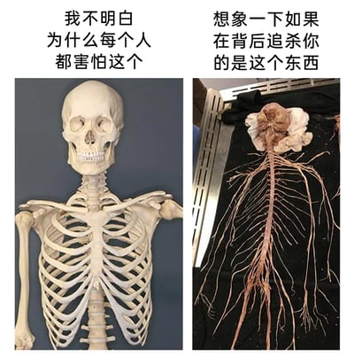 这是一张左右对比的静态梗图，左侧展示的是大众较为熟悉的人体上半身骨骼模型，配文“我不明白为什么每个人都害怕这个”，表达对人们恐惧骨骼的疑惑；右侧是完整剥离出来的胸腔神经结构标本，细密的神经分支如同蛛网般蔓延，配文“想象一下如果在背后追杀你的是这个东西”，引导观者感受这种少见人体结构带来的恐怖感。图中通过对比常见的骨骼和少见的神经标本，制造出恐惧反差的搞笑效果，调侃了人们对熟悉和陌生人体结构的不同恐惧反应，结合了解剖学素材和搞笑文案，兼具科普性和趣味性。