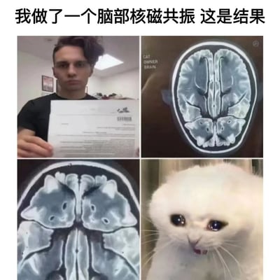 这是一张四格拼接图，上方配有文字“我做了一个脑部核磁共振 这是结果”。左上角是一名男性手持文件的照片，右上角是一张脑部扫描图，上面标注着“CAT OWNER BRAIN”，并在大脑结构中可以看到猫脸图案。左下角是另一张脑部扫描图，同样在大脑结构中呈现出猫脸图案。右下角是一只表情惊讶的白猫特写。图片通过将人类脑部扫描图与猫脸图案结合，幽默地暗示猫主人满脑子都是猫。