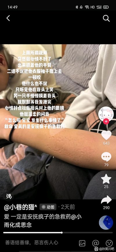 这是一条记录情侣日常的抖音截图，博主分享自己在上厕所刷视频时突然情绪低落，出来后抓过男朋友的手臂咬了下去发泄情绪，男朋友没有制止或生气，只是笑着摸她的头默默等待她发泄完毕，等她情绪平复后才温柔询问她发生了什么。博主借此感慨“爱真的是安抚疯子的急救药”，图中清晰展示了被咬后留下痕迹的手臂，传递出亲密关系里的温暖与治愈感。