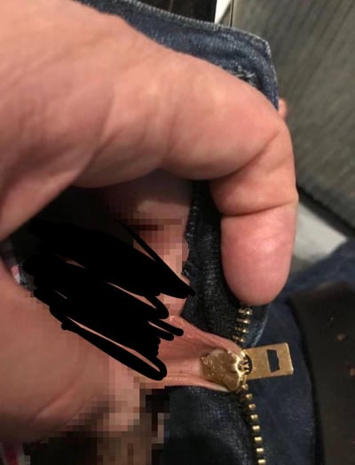 特写镜头下，一只手正在费力地试图拉上牛仔裤的拉链，拉链卡在中间位置，显示出裤子过紧的尴尬场景。图片中部分区域有黑色涂鸦遮盖和马赛克处理，可能是为了保护隐私。这种日常小困扰很容易引起共鸣，展现了人们在穿紧身衣物时可能遇到的窘境。