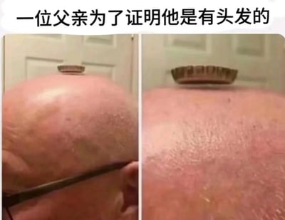 图片上方配有文字'一位父亲为了证明他是有头发的'，下方是两张左右对比的头部特写照片。左侧照片中可见一个光亮的光头，头顶放置了一个小型圆形物体（疑似碗或盖子）；右侧照片是该光头的更近距离特写，清晰展示了头皮细节，未见明显头发。整体通过对比突出父亲试图证明有头发却适得其反的幽默效果，属于生活趣事类搞笑梗图。