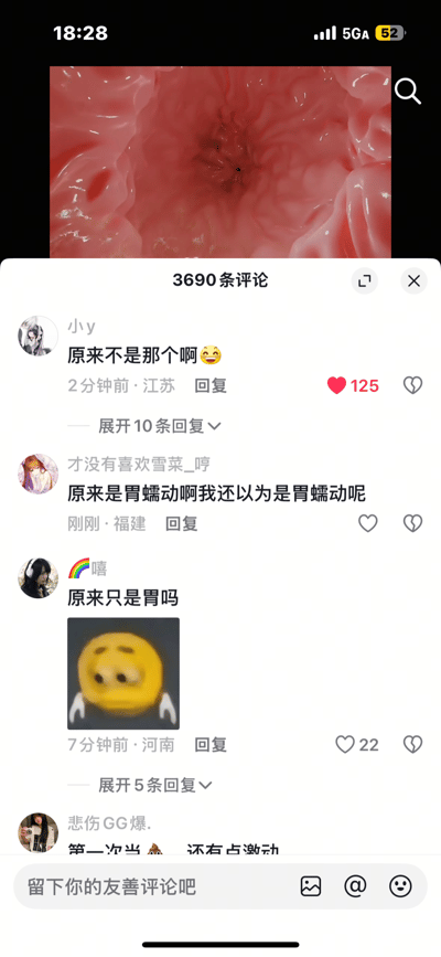 这是抖音平台的短视频评论区截图，上方视频画面为内镜拍摄的胃部蠕动场景，因画面视觉效果容易引发联想，评论区网友纷纷玩梗：有网友表示“原来不是那个啊😆”，还有网友用反向调侃的语气说“原来是胃蠕动啊我还以为是胃蠕动呢”，另有网友配上尴尬心虚的变异版流汗黄豆表情包，整体氛围搞笑有趣，展现了网友们的趣味互动。
