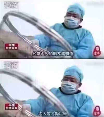 这是一张双面板的搞笑梗图，使用了医疗工作者的视频截图。上图中一位穿着蓝色手术服、戴着口罩和手术帽的医护人员手持一个金属环状器械，配文"经常杀人的朋友都知道"。下图是同一人同一动作的延续，配文"杀人容易抛尸难"。图片通过将医疗场景与犯罪话题意外结合，创造出黑色幽默效果。