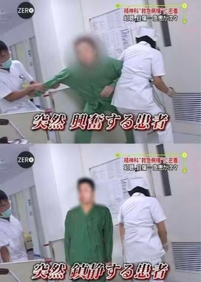 这是一张上下对比的医院场景截图，展示了精神科患者从兴奋状态到镇静状态的转变过程。上图中，一名穿着绿色病号服的患者正被医护人员约束，表情激动；下图中，同一名患者已恢复平静，独自站立。图片带有日文说明文字，推测来自日本某医疗相关纪录片或电视节目。
