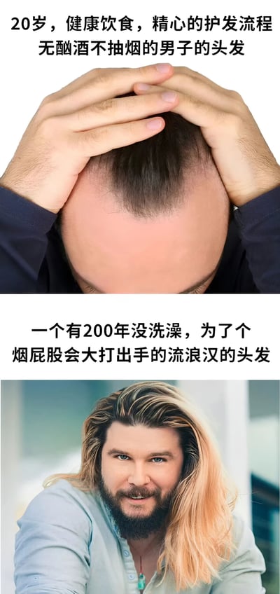 图片为上下对比图，上方展示一位20岁、坚持健康饮食和护发流程、无不良嗜好的男子，他双手抓着自己秃顶的头顶，显得十分无奈；下方则是一位被描述为“200年没洗澡、会为烟屁股大打出手”的流浪汉，却拥有一头浓密飘逸的长发，形成强烈反差，通过夸张对比制造幽默效果，吐槽脱发问题的不可预测性。